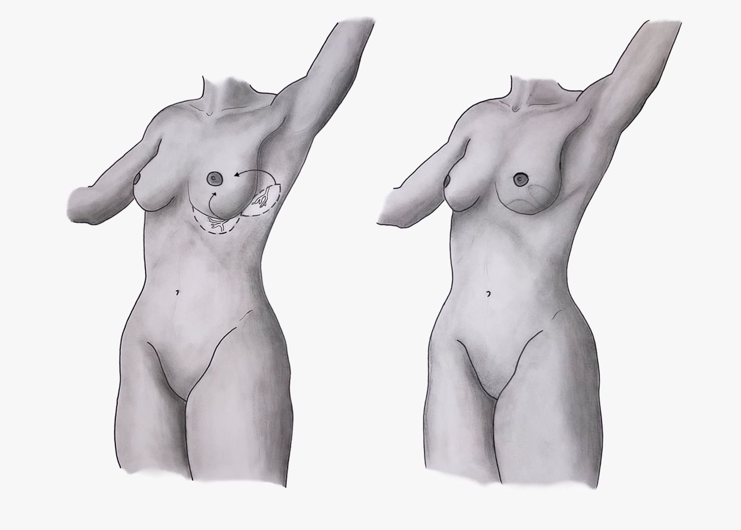 Medical Study