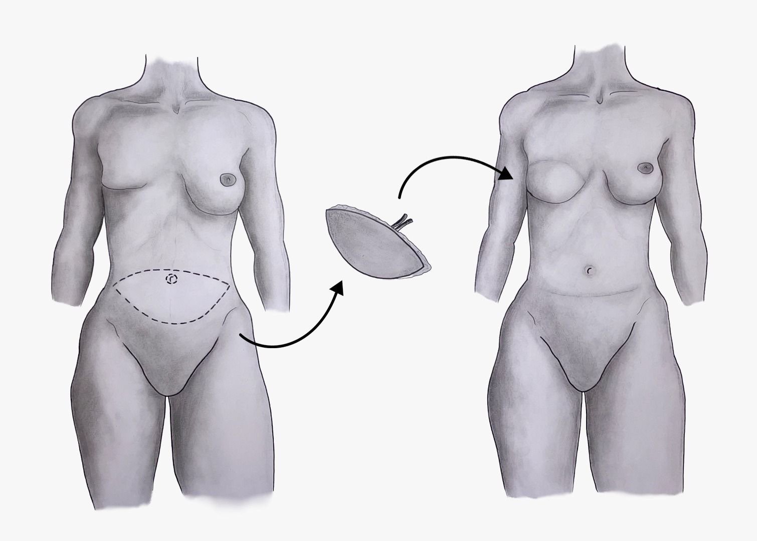 Medical Drawings